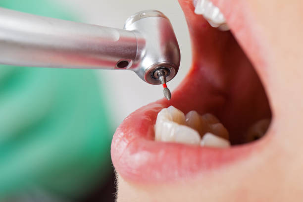 Best Tooth Infection Emergency Dentist  in Sea Girt, NJ